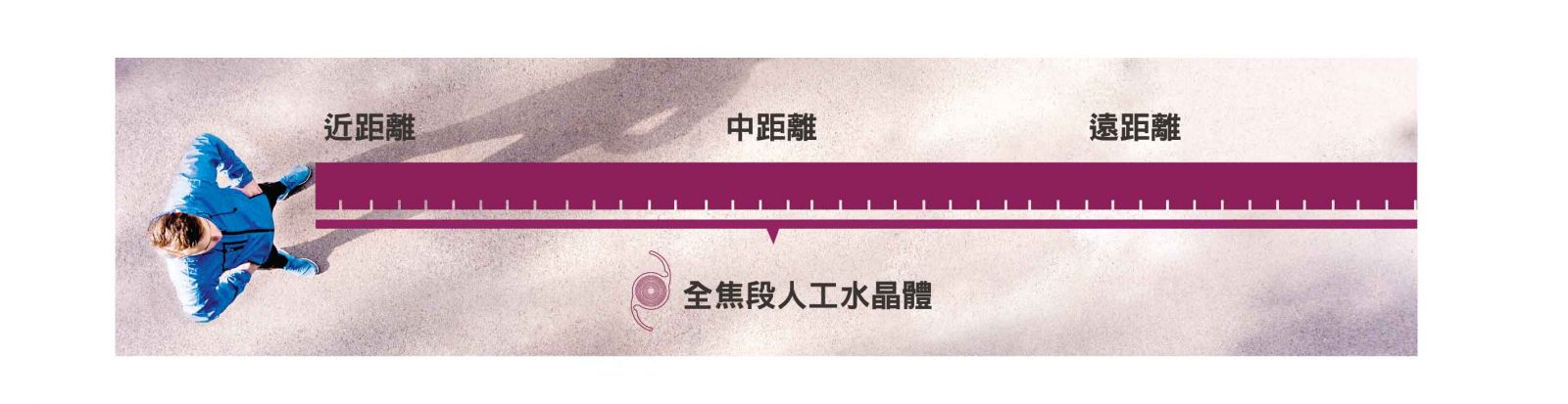 全焦段 散光矯正 白內障手術  白內障症狀  白內障治療  白內障手術術後當天  白內障手術術後隔天